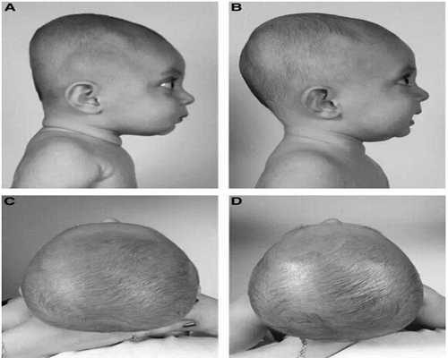2026试管科普:鲜胚级别8i和10ii质量评估与助孕移植建议
